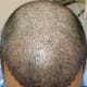 Frontal area