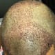 This is how my frontal area looks