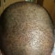 Top view of the frontal area