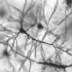 Nerve cells in the Hippocampus region of the brain