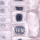 La célula central superior está en interfase (núcleo aún visible); la célula inferior está en metafase tardía / anafase temprana
