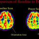 Scans of Franciscan nuns in prayer, shows activity in the superior parietal lobe, where the brain's responsibility is for orientation. Activity decreases significantly during prayer as per Newberg’s study.