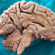 Mother Nature must be really fond of the brain because she's copied it in so many places in the plant and fungal worlds. The human brain weighs on average 3.3 pounds (1.5 kg).