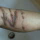 box jelly fish stings as hell...