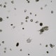 A flagellate is a type of protozoa. Flagellated Protozoa Radiolaria