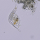 Protozoa, Ciliate, Dileptus anser identified using Covich's Ecology and Classification of North American Freshwater Invertebrates