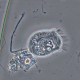 Ciliated Protozoa Vorticella