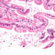 A flagellate is a type of protozoa. High magnification micrograph of a small bowel mucosa (duodenum) biopsy with giardiasis. H&E stain. Giardiasis is due to the flagellate protozoan