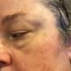 Feb 21, 2017. After a week or two treatment with Frankincense, a couple finger-like projections are starting to form. Time for oregano oil.