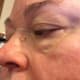 Feb 22, 2017. Just one day later, appearance is noticeably different.