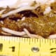 Roundworms in Stool