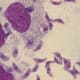 Cat parasites . . . fun.