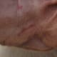 If your dog has scratches or abrasions do not clean the ear with vinegar.