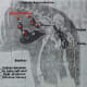 Spaying a cat or dog removes the whole uterine chain