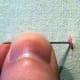 Figure 3: Splitting your first stitch