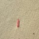Figure 1: Start by making a running stitch