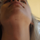 Scratches on the face.