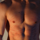 Scratches on the stomach and chest.