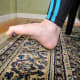 Toe scrunch. Try picking up a small object like a marble with your toes.