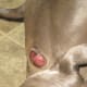 The cyst that was really a tumor