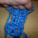 The other side of the stitches.