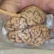 Inspecting the brain before making any cuts
