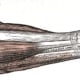 Be aware of symptoms involving legs and arms.