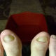 April 20, 2014. The bottom part of the nails on my big toes are starting to look normal and the rest of the nails are starting to turn clear.