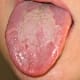Geographic Tongue WikiMedia/Commons/ageekgal
