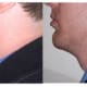 A prominent chin is eqated as a 'strong' chin