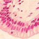 Stratified Columnar H&E Stain
