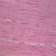 Smooth Muscle H&E Stain