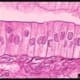 Simple Columnar H&E Stain