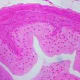 Transitional Epithelium H&E Stain