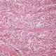 Dense Irregular Connective Tissue H&E Stain