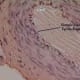 Simple Squamous Epithelium H&E Stain