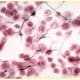 Reticular Connective Tissue H&E Stain with Silver Impregnation