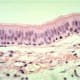 Pseudostratified Columnar H&E Stain