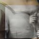 Detail from Raphael, The Madonna of the Pinks, showing changes to the underdrawing