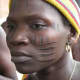 Facial scarring is a distinct feature of the Tsonga tradition