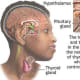thyrotoxicosis-personal-experiences-of-living-with-thyroid-problems