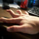 klippel-trenaunay-webber-syndrome-my-story
