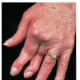 natural-anti-inflammatory-remedies-for-arthritis