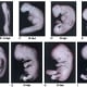 Stages of the Human baby...certainly metamorphism at it's most profound