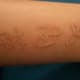 white-ink-tattoos-and-designs-white-tattoos-and-ideas-white-ink-tattoo-pictures