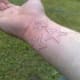 white-ink-tattoos-and-designs-white-tattoos-and-ideas-white-ink-tattoo-pictures