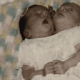 the-amazing-lives-of-abby-and-brittany-hensel