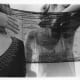 artists-who-died-before-30-francesca-woodman