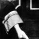 A bound foot was a hallmark of beauty. The actual foot was folded in half and tied down for years. This is the result that cannot be reversed.