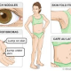 nf-neurofibromatosis-voices-what-some-of-us-want-you-to-know